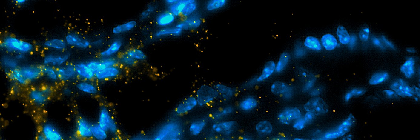 Fanny Franchini banner