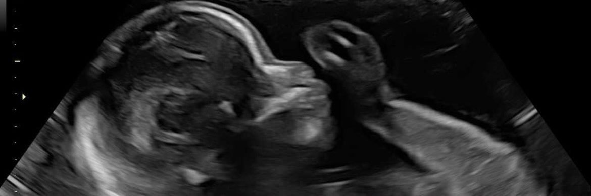 D0nflict's profile banner image