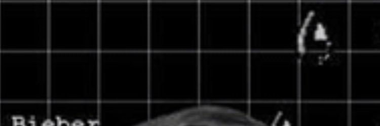 dyo_dyoo's profile banner image