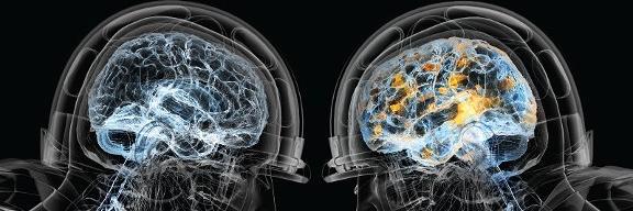 ConcussionFact's profile banner image