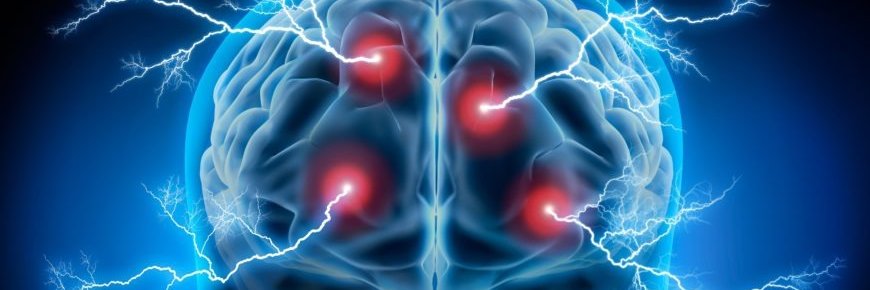 scepilepsy's profile banner image