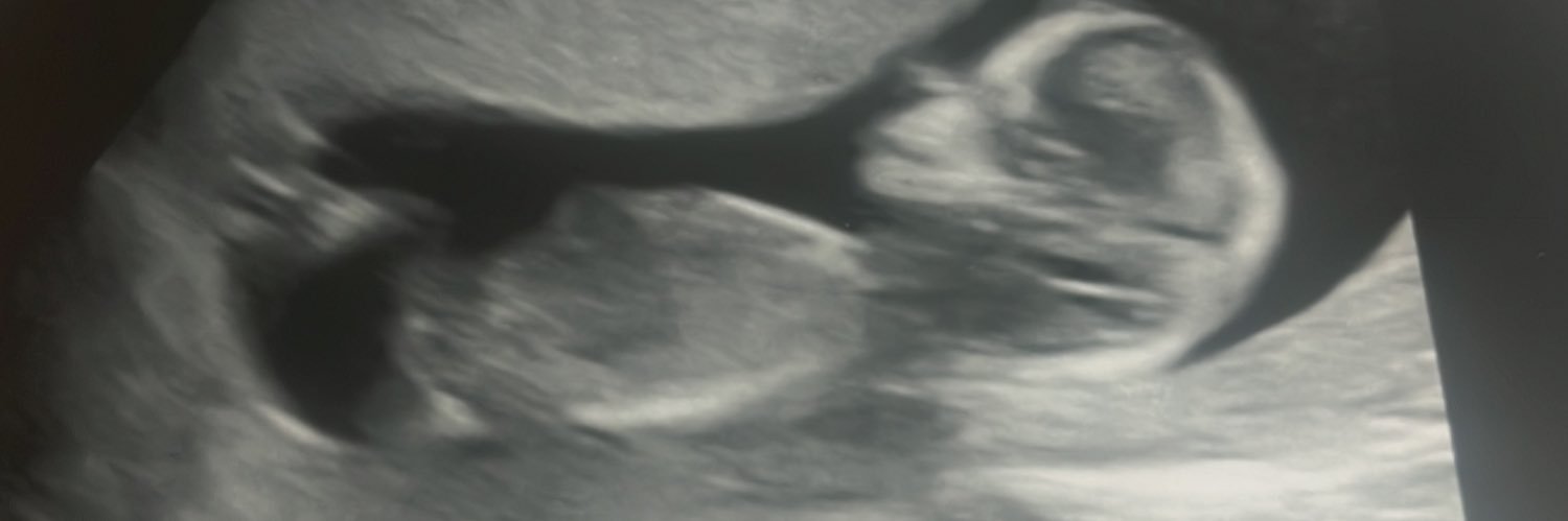 SteffAtkin's profile banner image