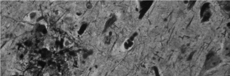 De Strooper Lab banner