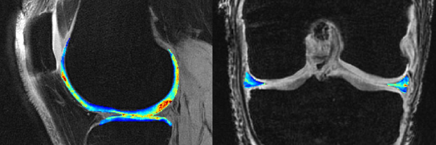 Matthew Koff PhD banner