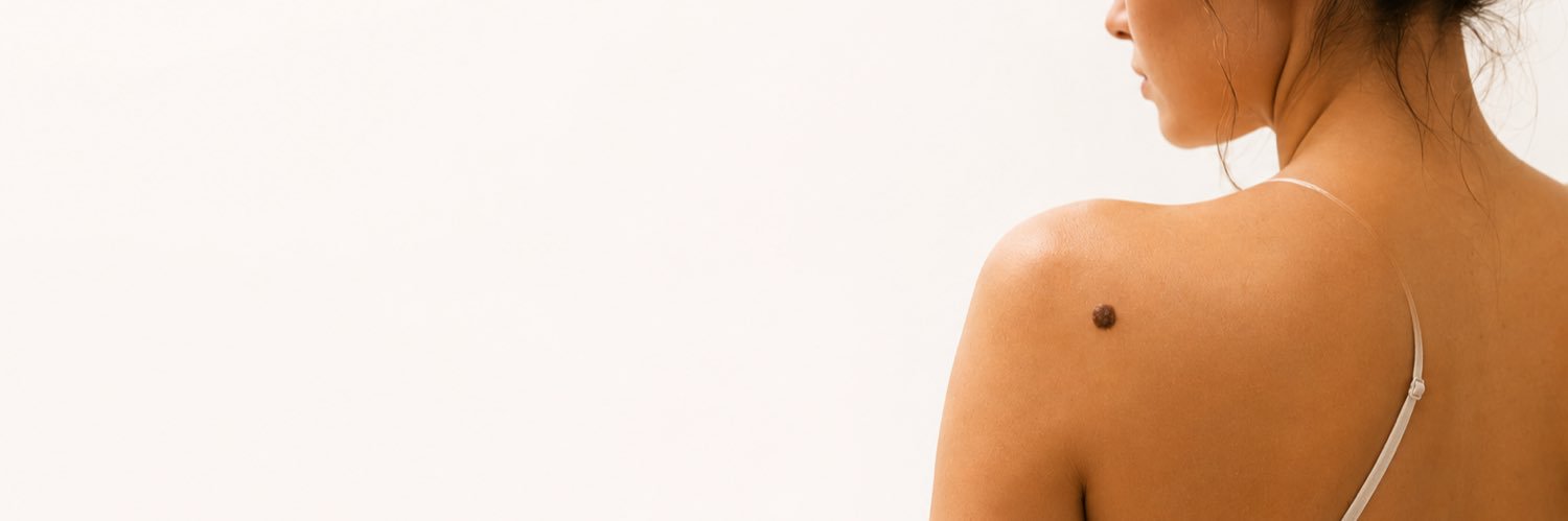 SkinCheckerApp's profile banner image