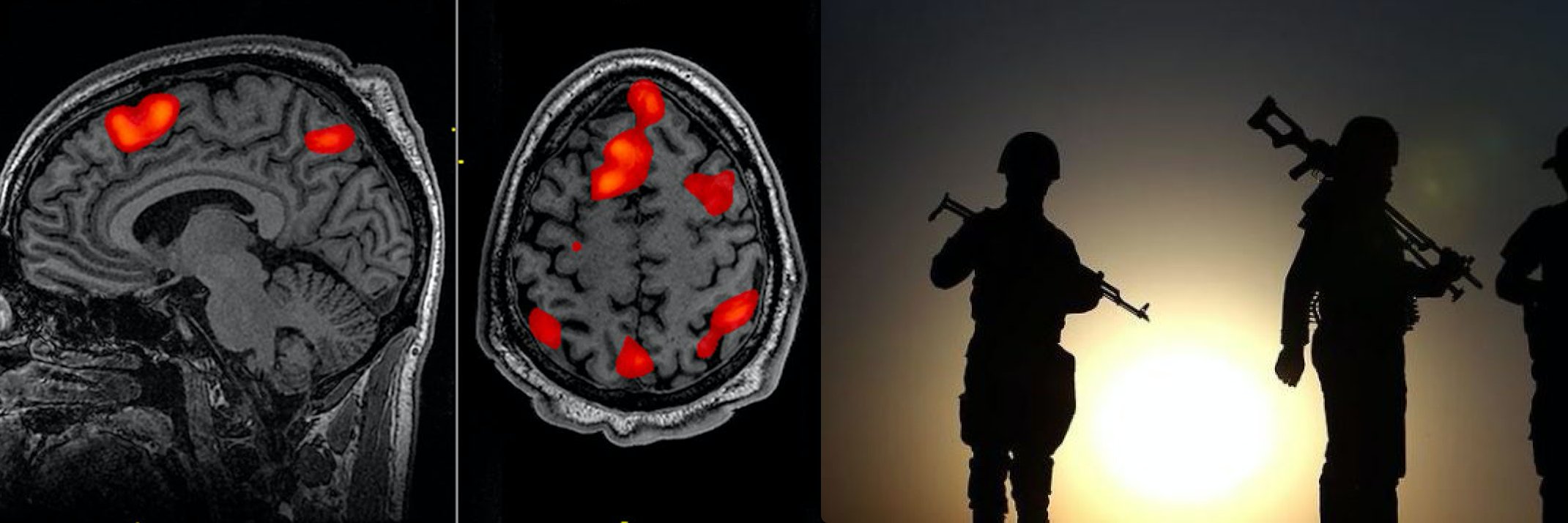 Nafees Hamid, PhD banner