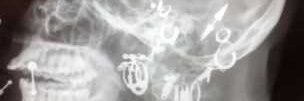 MiranKoderman's profile banner image
