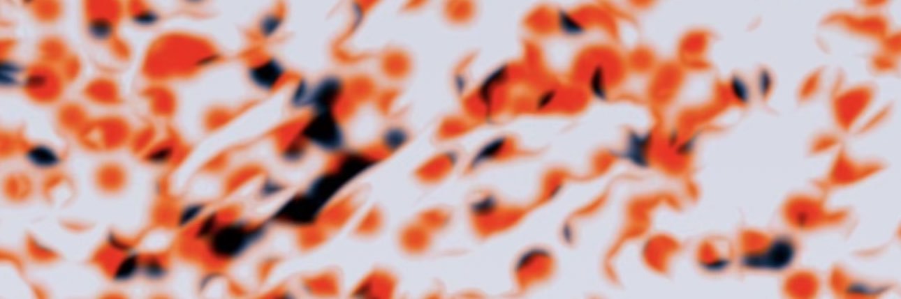 Parker banner