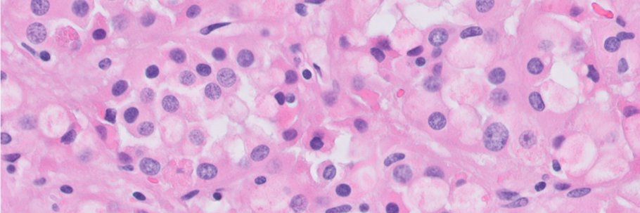 Cornelia Ding, MD, PhD banner