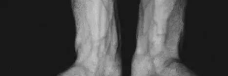 جيپ غامبرديلا banner