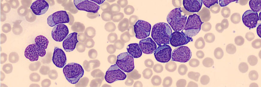 Alex Bataller banner