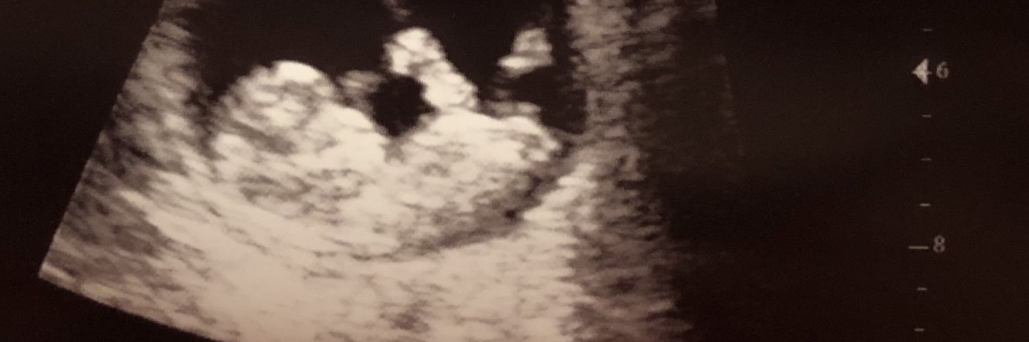 KayleeBuckley96's profile banner image
