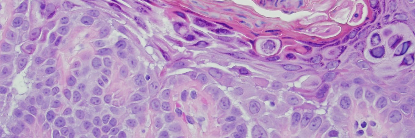 MDermTips's profile banner image