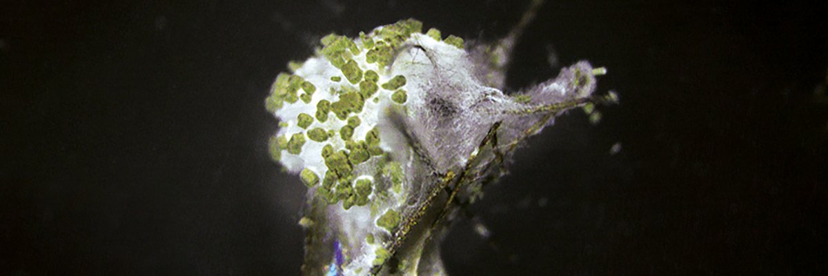 Nature Microbiology banner