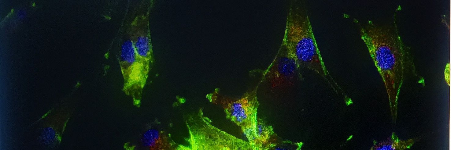 Vinay Kumar, PhD banner