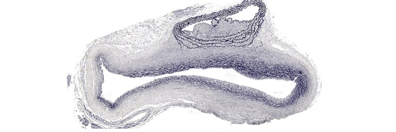 Alan Daugherty banner