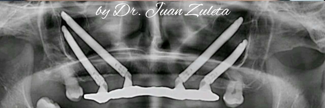 Juanendo's profile banner image