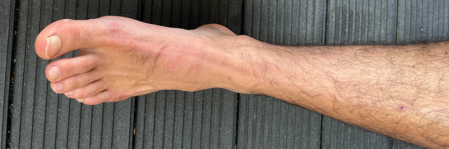 🇩🇪 SerkanHH 1981 Alpha Top banner