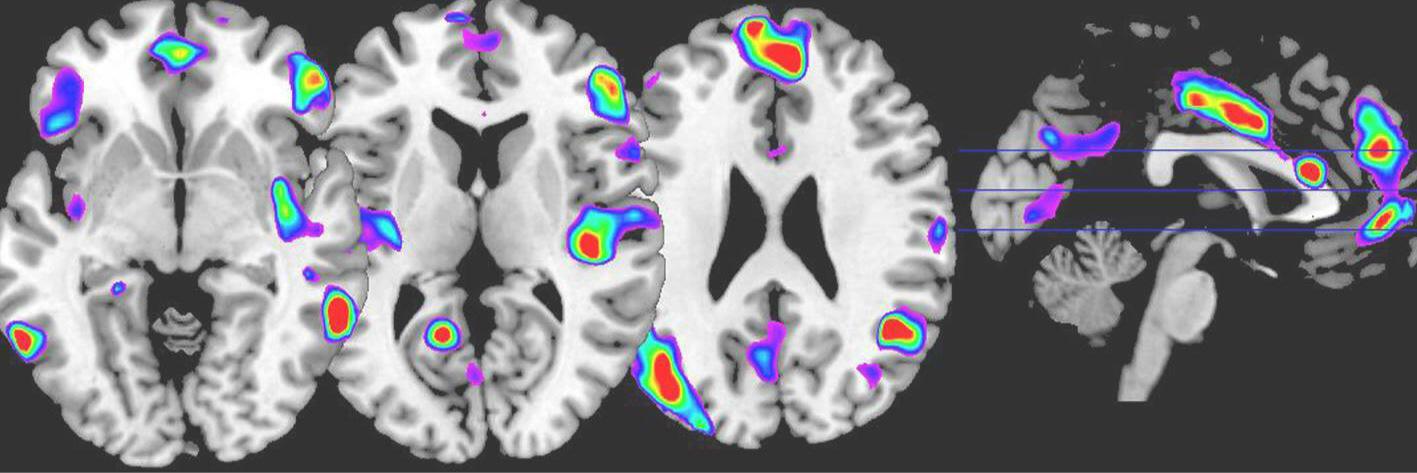 ClinicalBrainLab banner