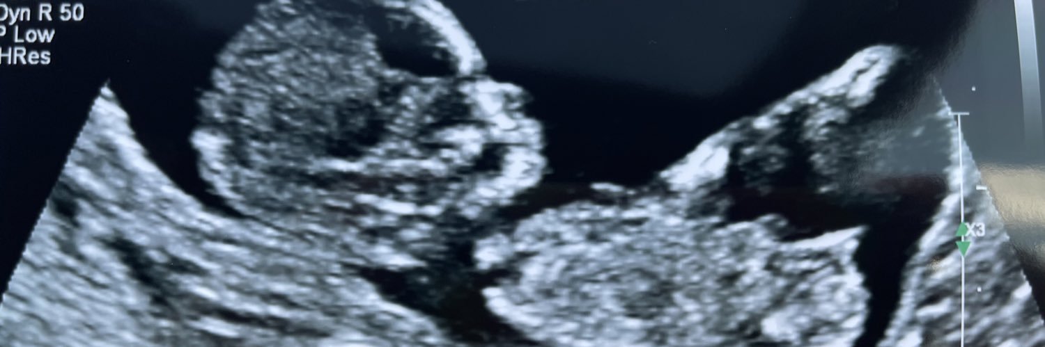 clr_16's profile banner image