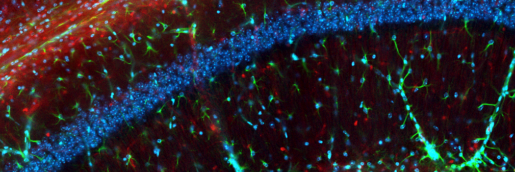 PerinatalBrain's profile banner image