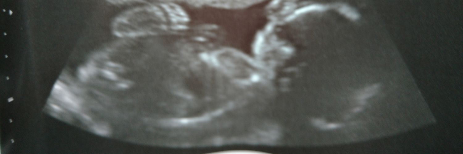 _justinesidney's profile banner image