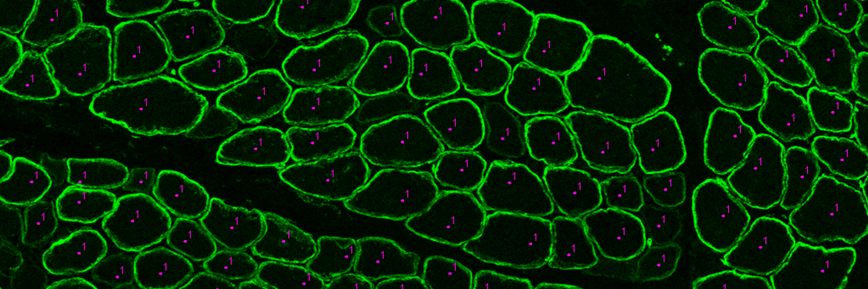 Prof. Karen Anthony banner