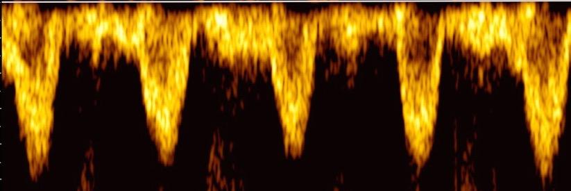 ExpensiveScare's profile banner image