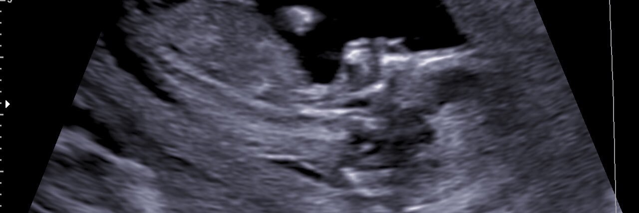 schumann_ashley's profile banner image
