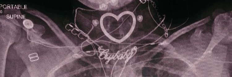 86 banner