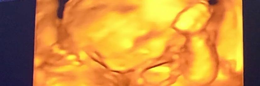 Putrirezka's profile banner image