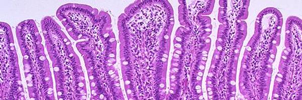 CeliacDoc Profile Banner