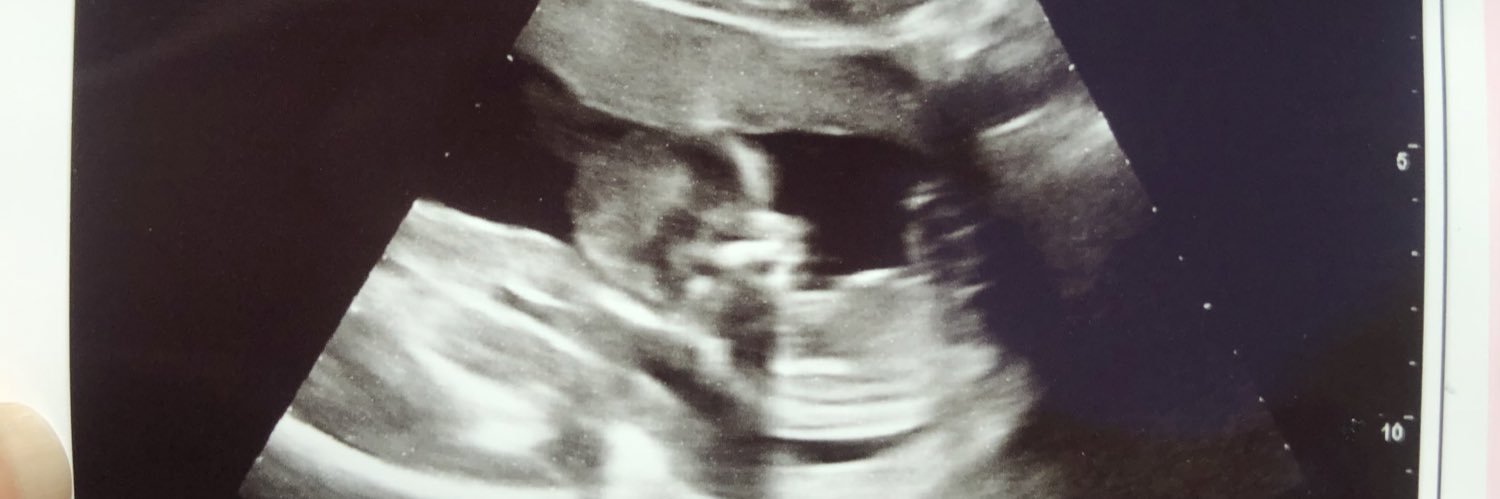 Dripcember 23rd🥶 banner