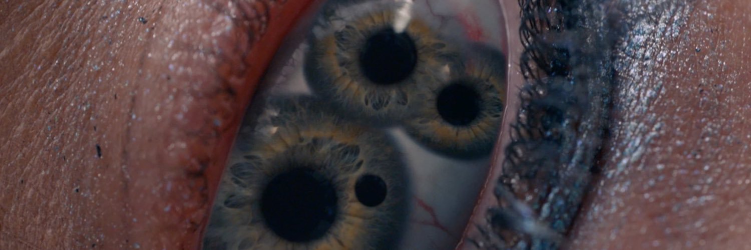 Remus banner