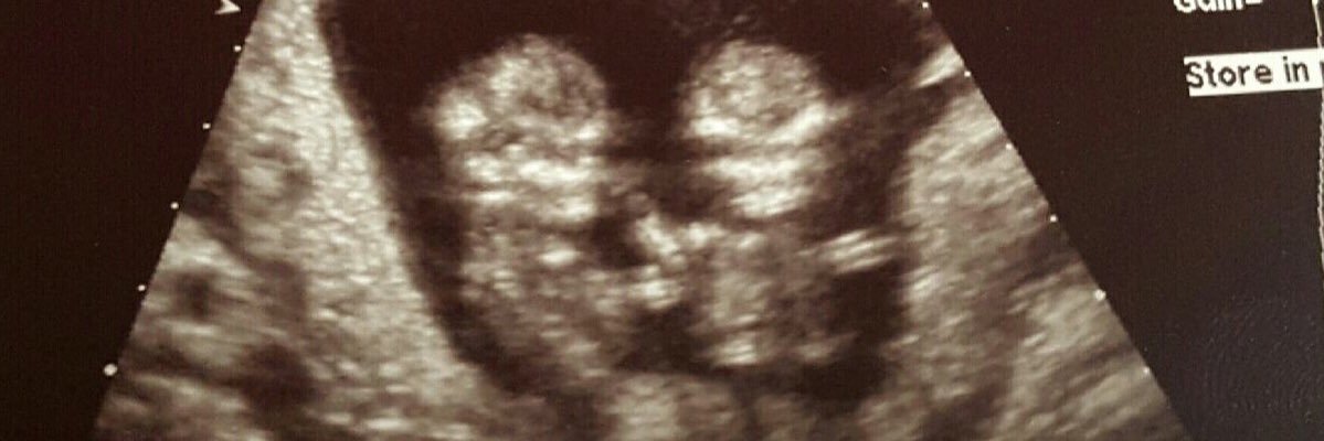 amaybabay's profile banner image