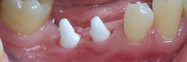 myceramicimplan Profile Banner