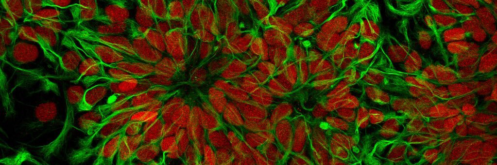 Yojet  Sharma banner