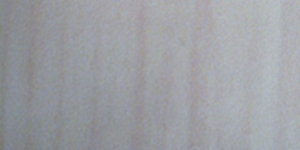 barry kudrowitz banner