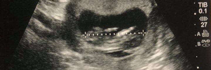 96HalfPint's profile banner image
