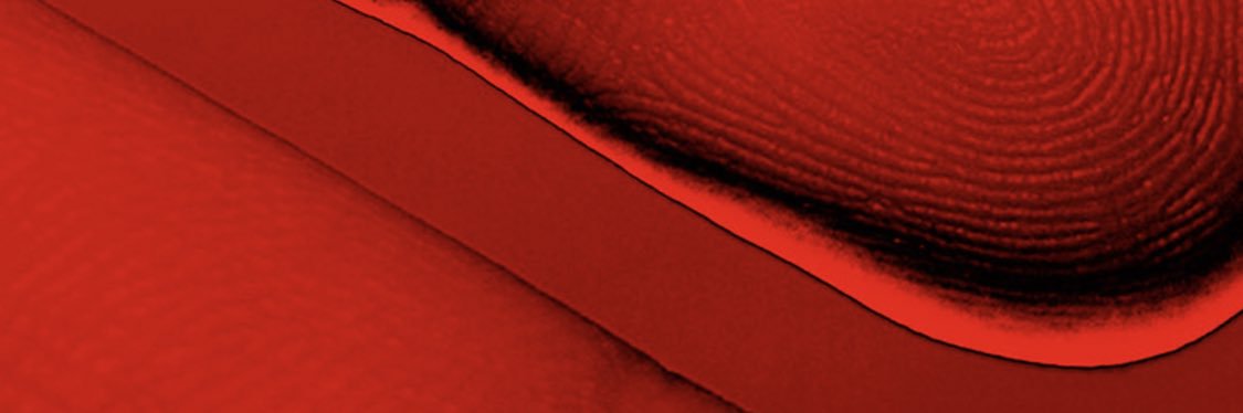 João Apel banner