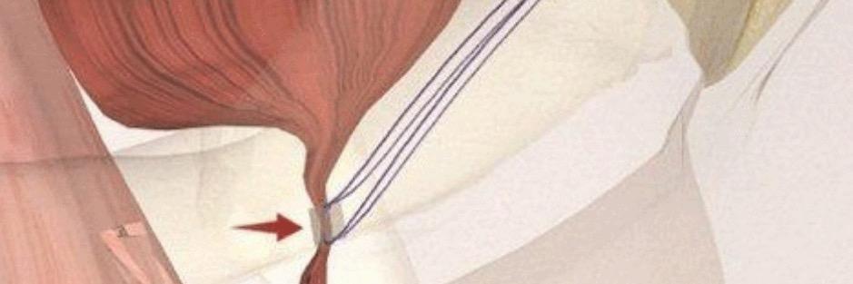 AdjustableSling's profile banner image