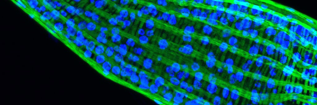 Neuroimmunity's profile banner image