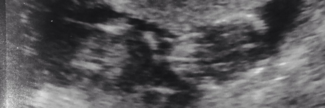 Kenco126's profile banner image