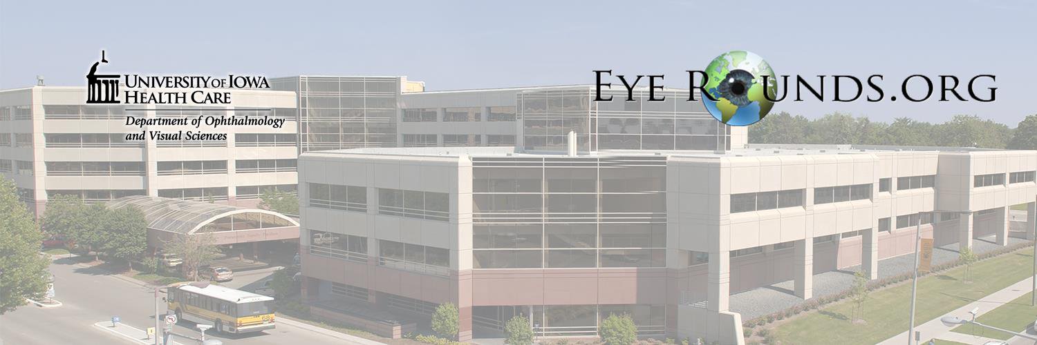 EyeRounds banner