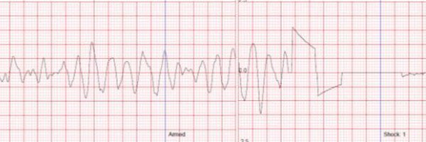 restartyorks Profile Banner