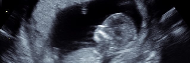 Faithnoelp's profile banner image