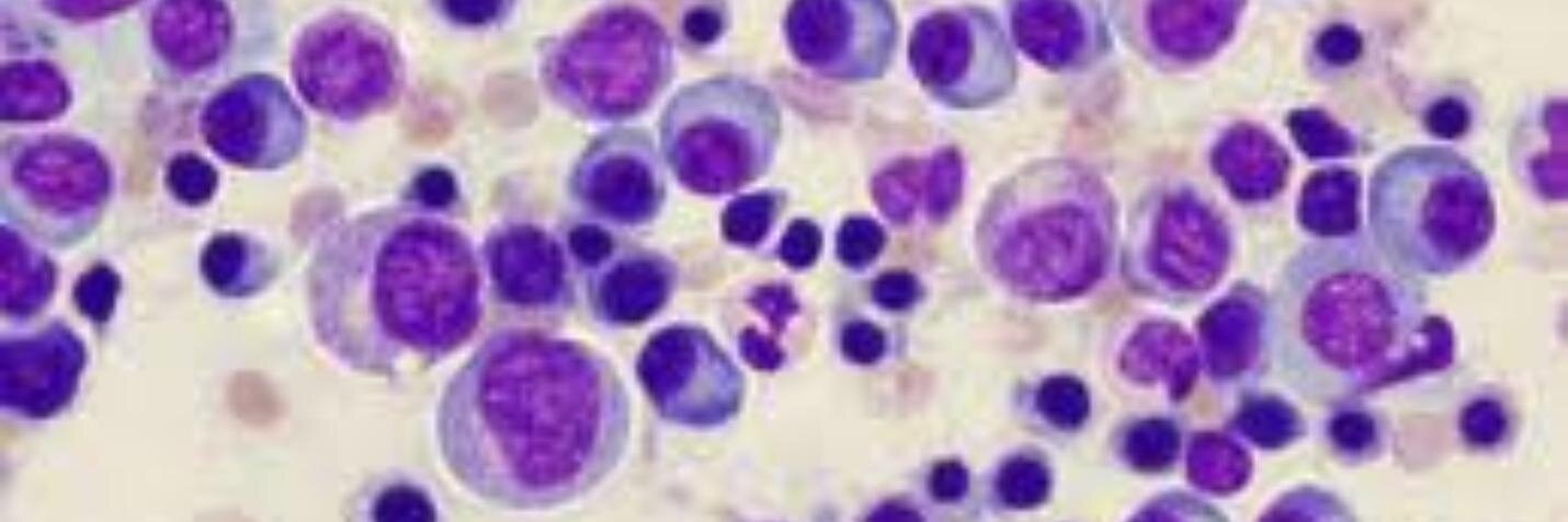 @MyelomaTeacher - Cindy Chmielewski's banner