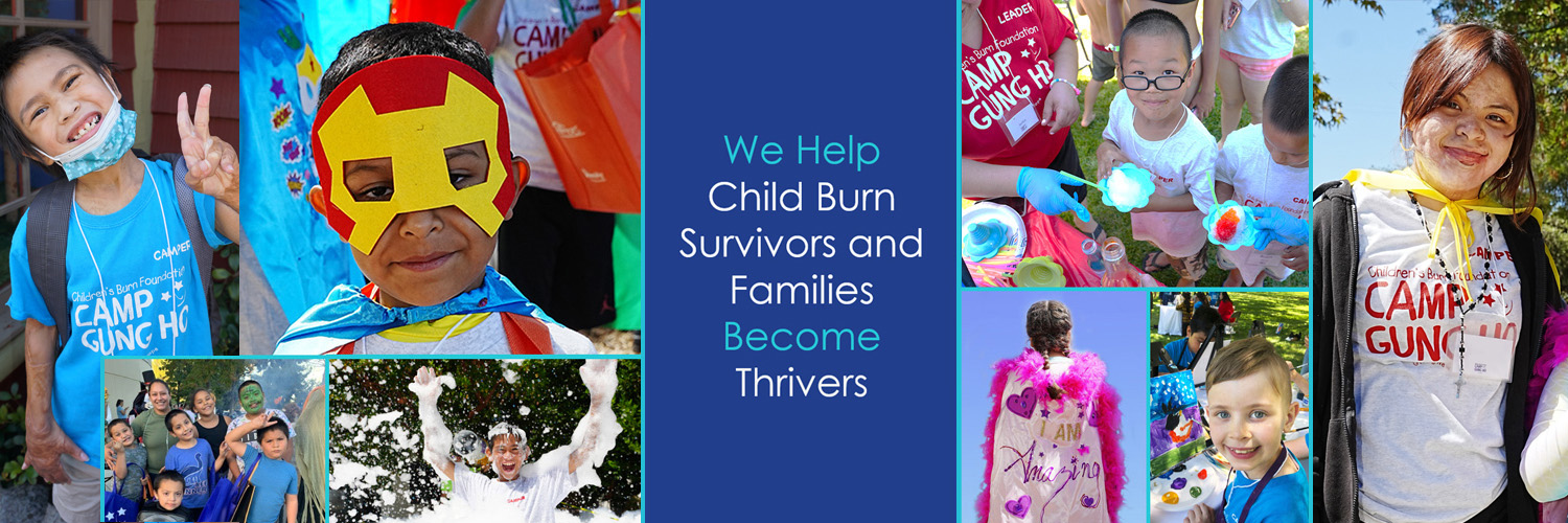 Children's Burn Fdn banner