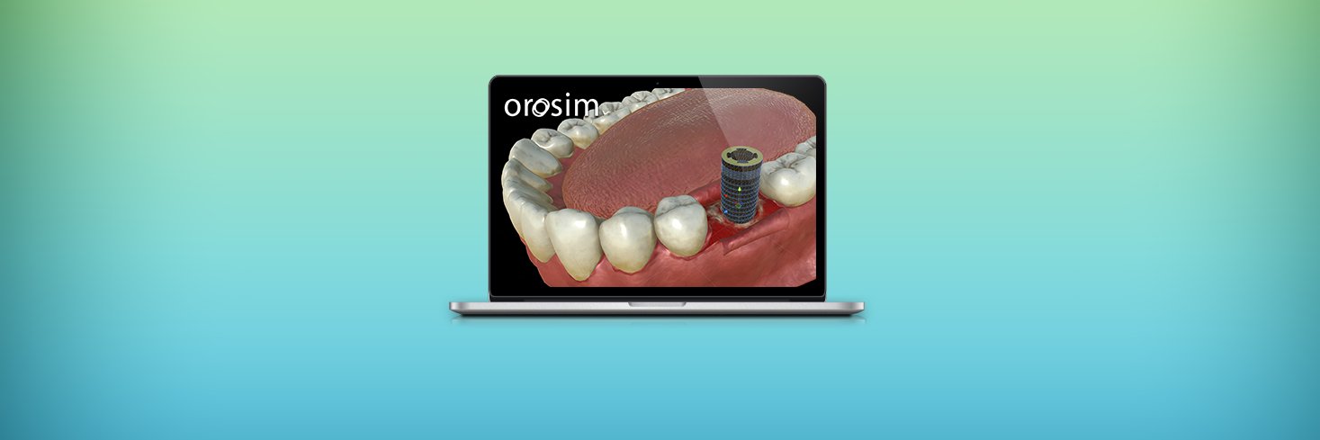 Orosim banner
