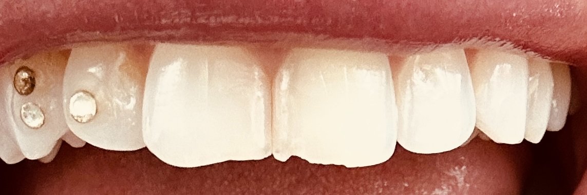 lolo banner